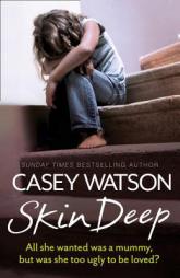 Skin Deep: All She Wanted Was a Mummy, But Was She Too Ugly to Love? by Casey Watson Paperback Book