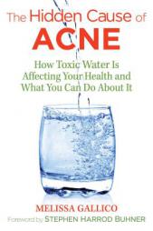 The Hidden Cause of Acne: How Toxic Water Is Affecting Your Health and What You Can Do about It by Melissa Gallico Paperback Book